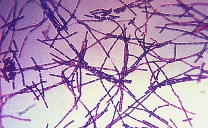 bacillus-anthracis-gram400-1397254035.jpg