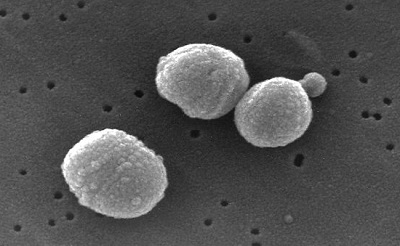 streptococcus-pneumoniae400-1383298403.jpg