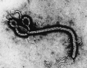 ebola2-1409077947.gif